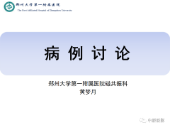 <b>舌神经鞘瘤1例MR影像</b>