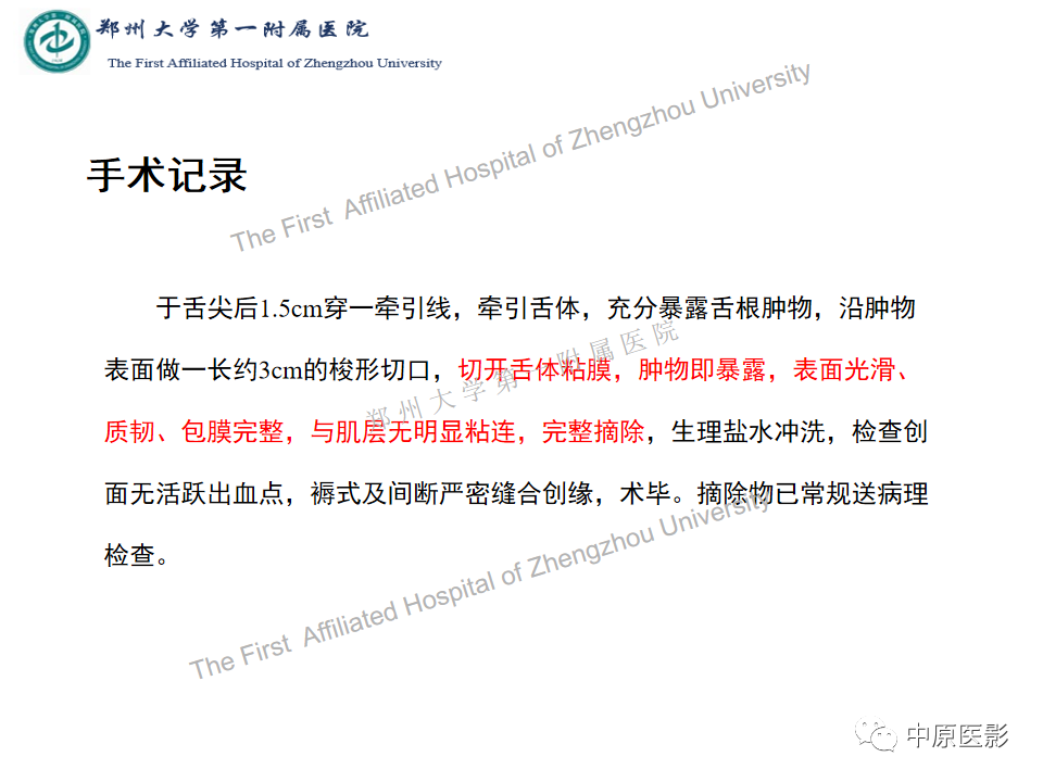 【病例】舌神经鞘瘤1例MR影像-8