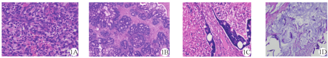 【病例】盆腔肿块，需要考虑到这个来源…-3