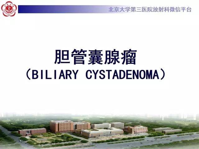 【病例】肝脏交界性粘液性囊腺瘤1例CT及MR影像-7