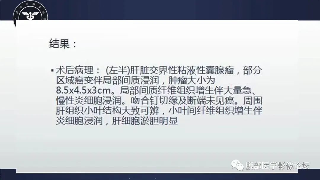 【病例】肝脏交界性粘液性囊腺瘤1例CT及MR影像-6