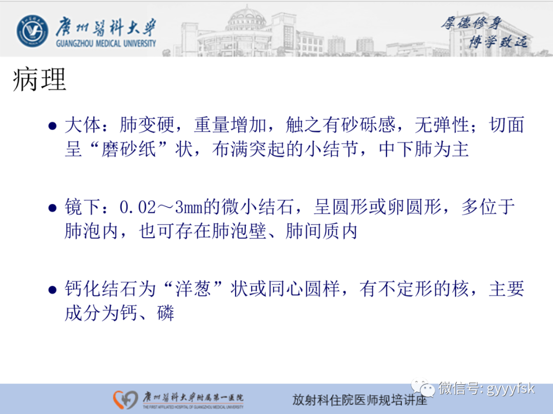 【PPT】肺泡微石症阅片指导-5