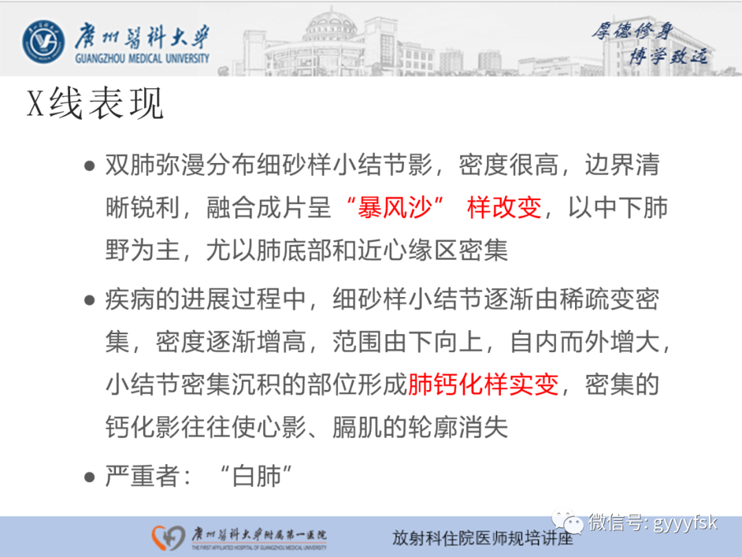 【PPT】肺泡微石症阅片指导-11