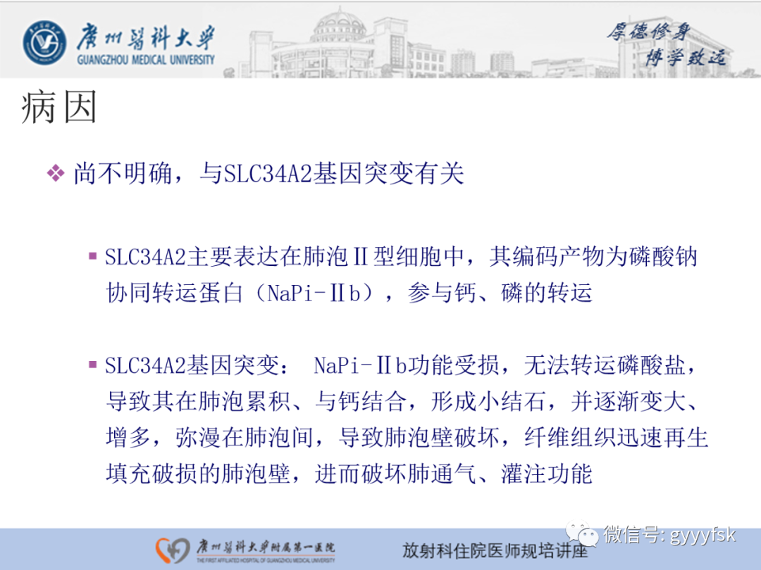 【PPT】肺泡微石症阅片指导-4