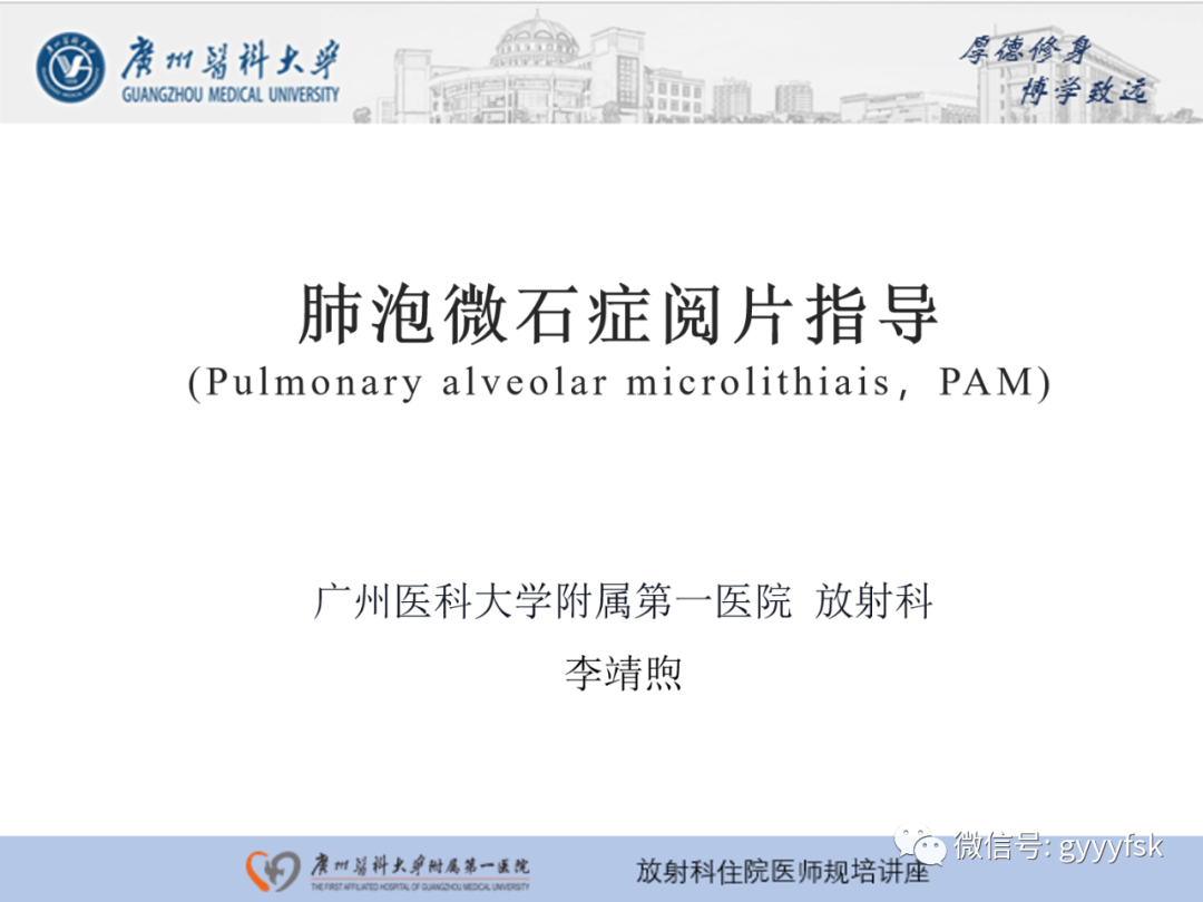 【PPT】肺泡微石症阅片指导-1