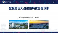 盆腹腔巨大占位性病变影像诊断