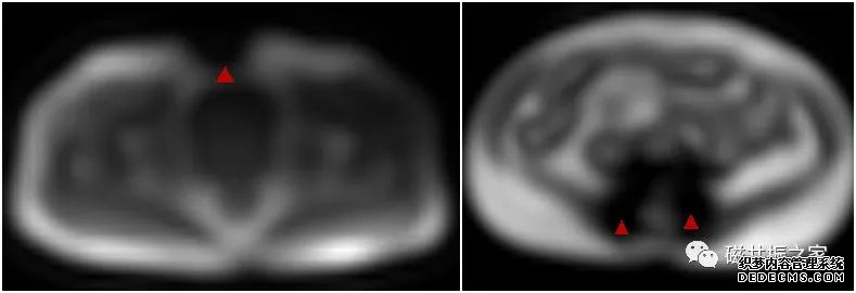 校准序列的“另类”应用-9 校准序列的“另类”应用-9