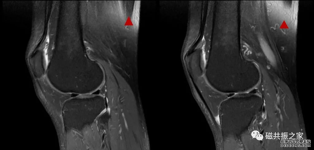 校准序列的“另类”应用-6 校准序列的“另类”应用-6