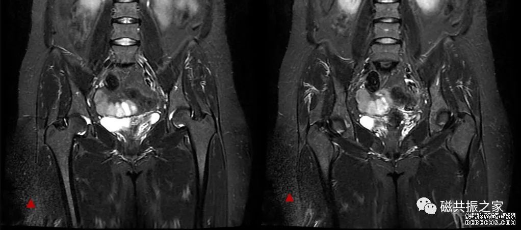校准序列的“另类”应用-5 校准序列的“另类”应用-5