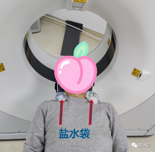 盐水袋可去除射线束硬化伪影-1