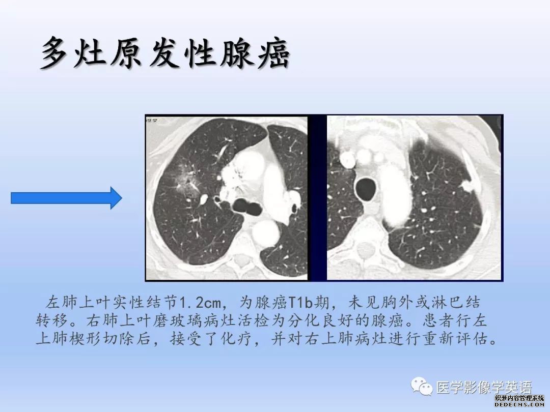 【PPT】肺腺癌TNM分期影像学解读-26