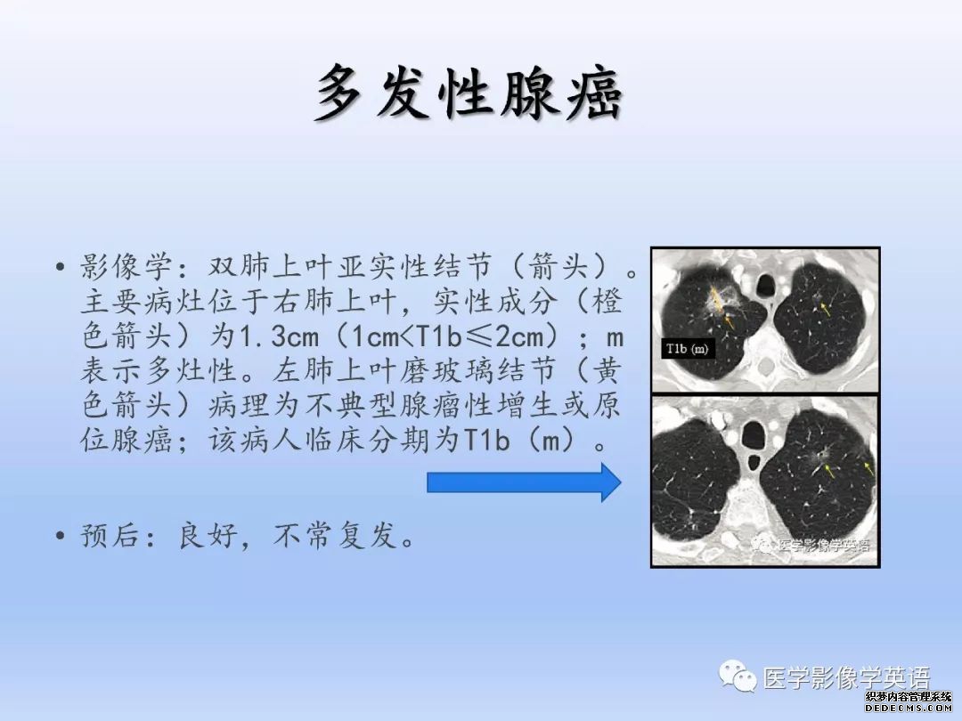 【PPT】肺腺癌TNM分期影像学解读-18