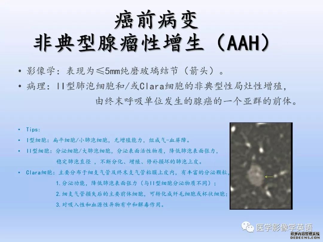 【PPT】肺腺癌TNM分期影像学解读-4
