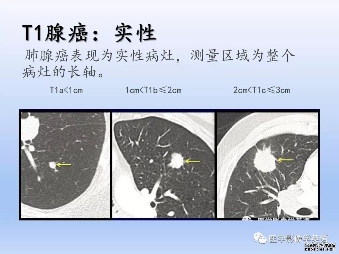 【PPT】肺腺癌TNM分期影像学解读-9