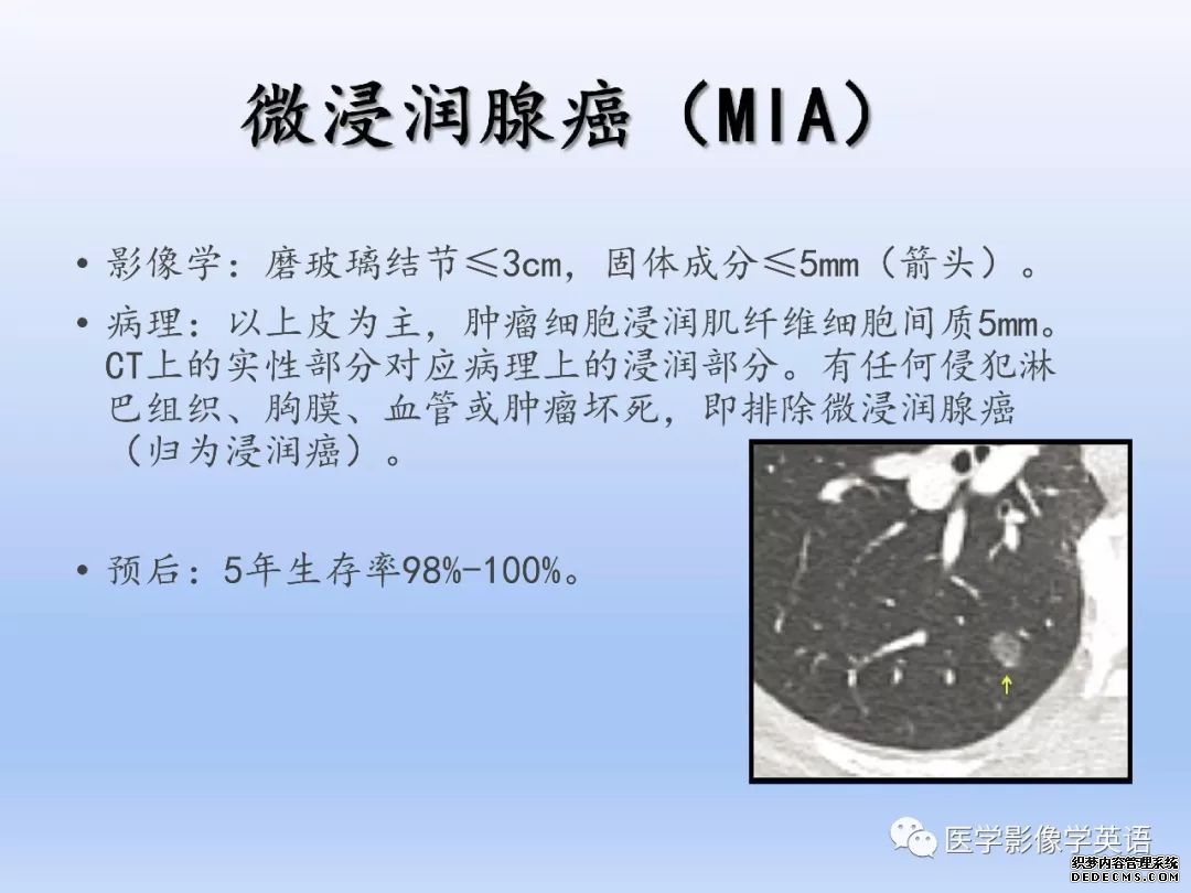 【PPT】肺腺癌TNM分期影像学解读-7