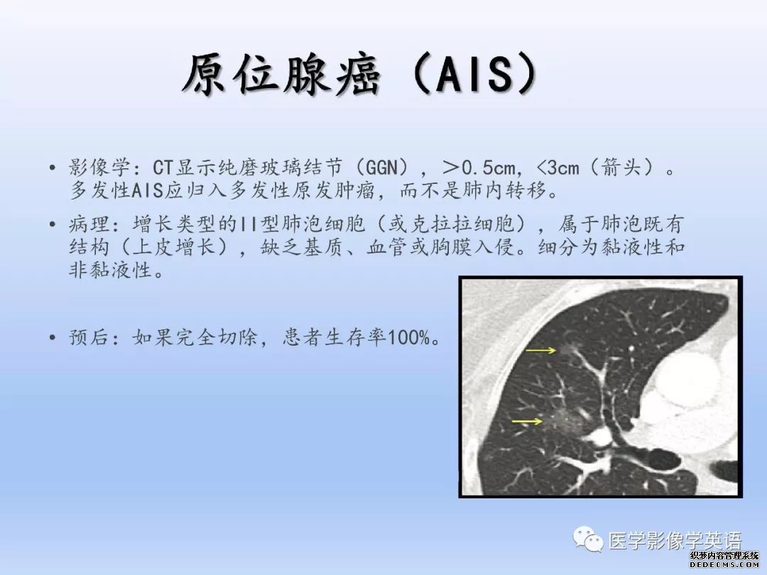 【PPT】肺腺癌TNM分期影像学解读-6
