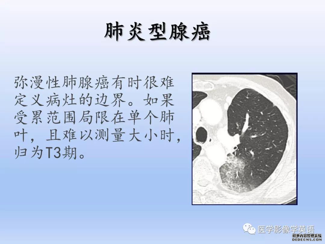 【PPT】肺腺癌TNM分期影像学解读-22