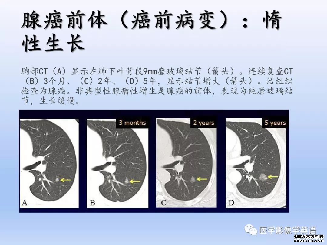 【PPT】肺腺癌TNM分期影像学解读-5