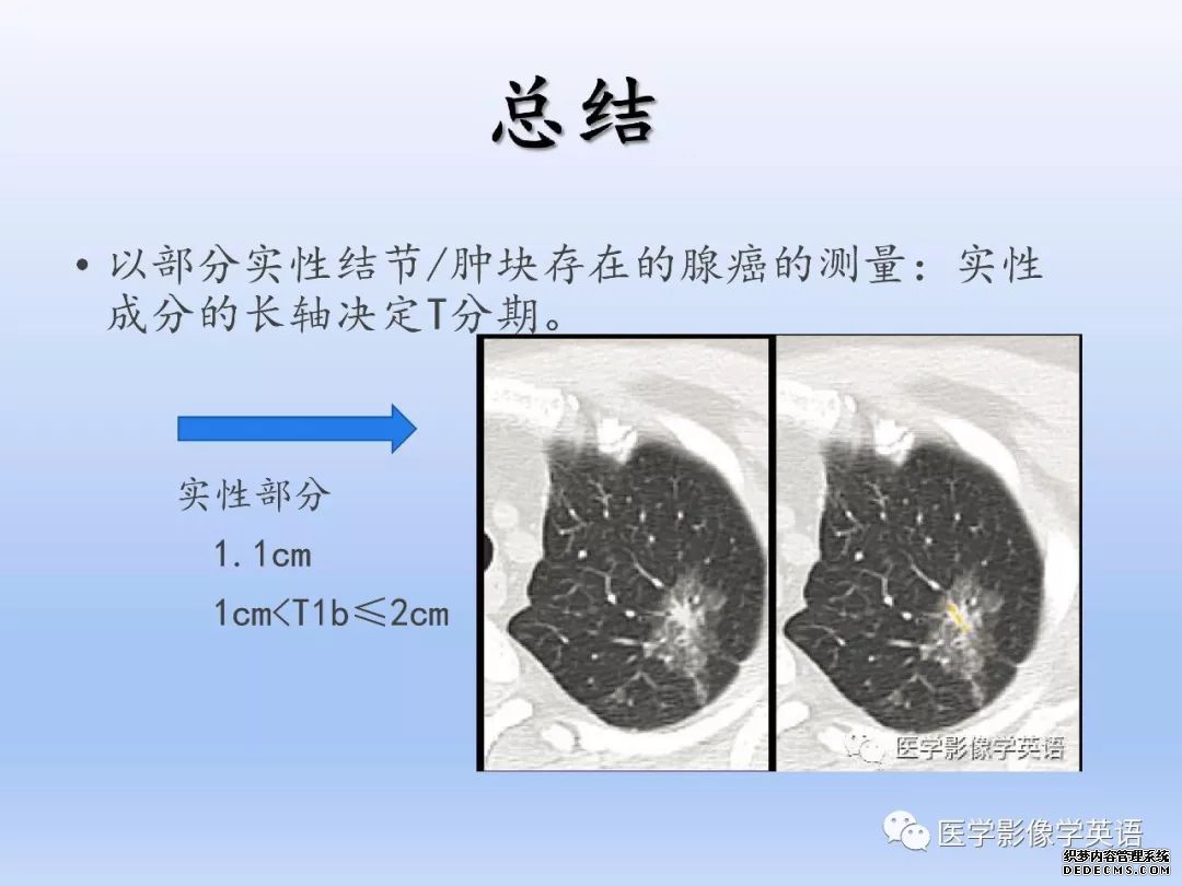 【PPT】肺腺癌TNM分期影像学解读-30