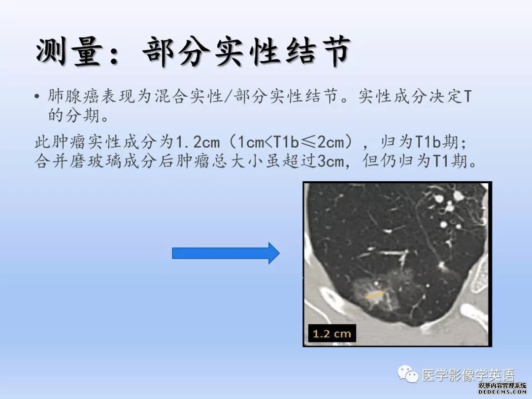 【PPT】肺腺癌TNM分期影像学解读-10