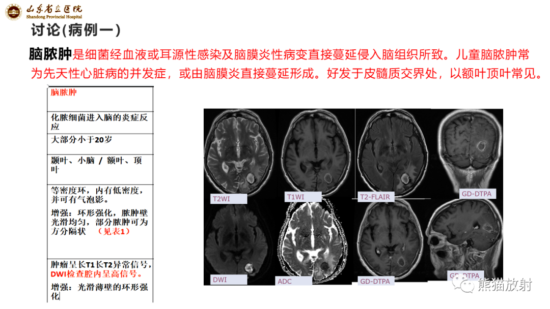 【病例】炎性肉芽肿并脓肿形成 & 成熟性囊性畸胎瘤-13