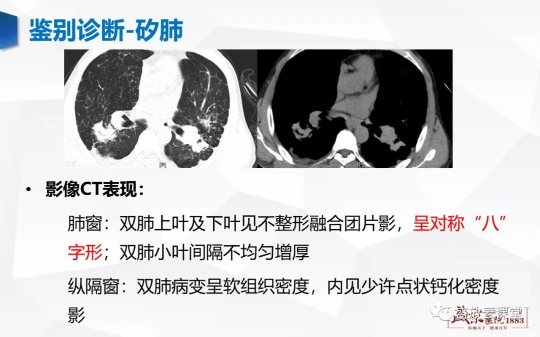 【病例】肺转移瘤1例CT影像-12