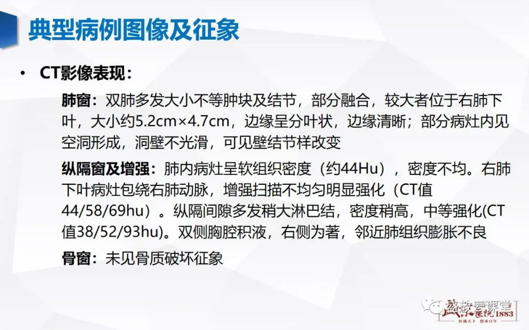 【病例】肺转移瘤1例CT影像-5