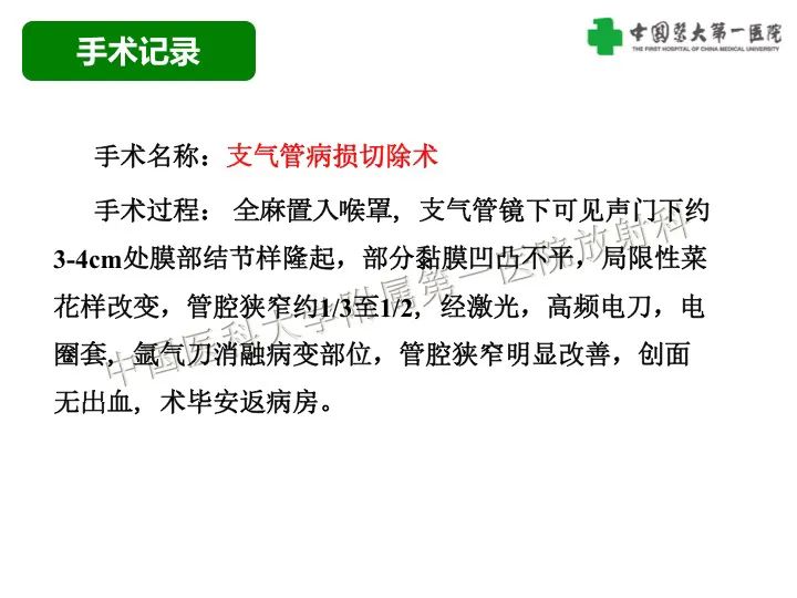 【病例】气管腺样囊性癌1例CT影像-6