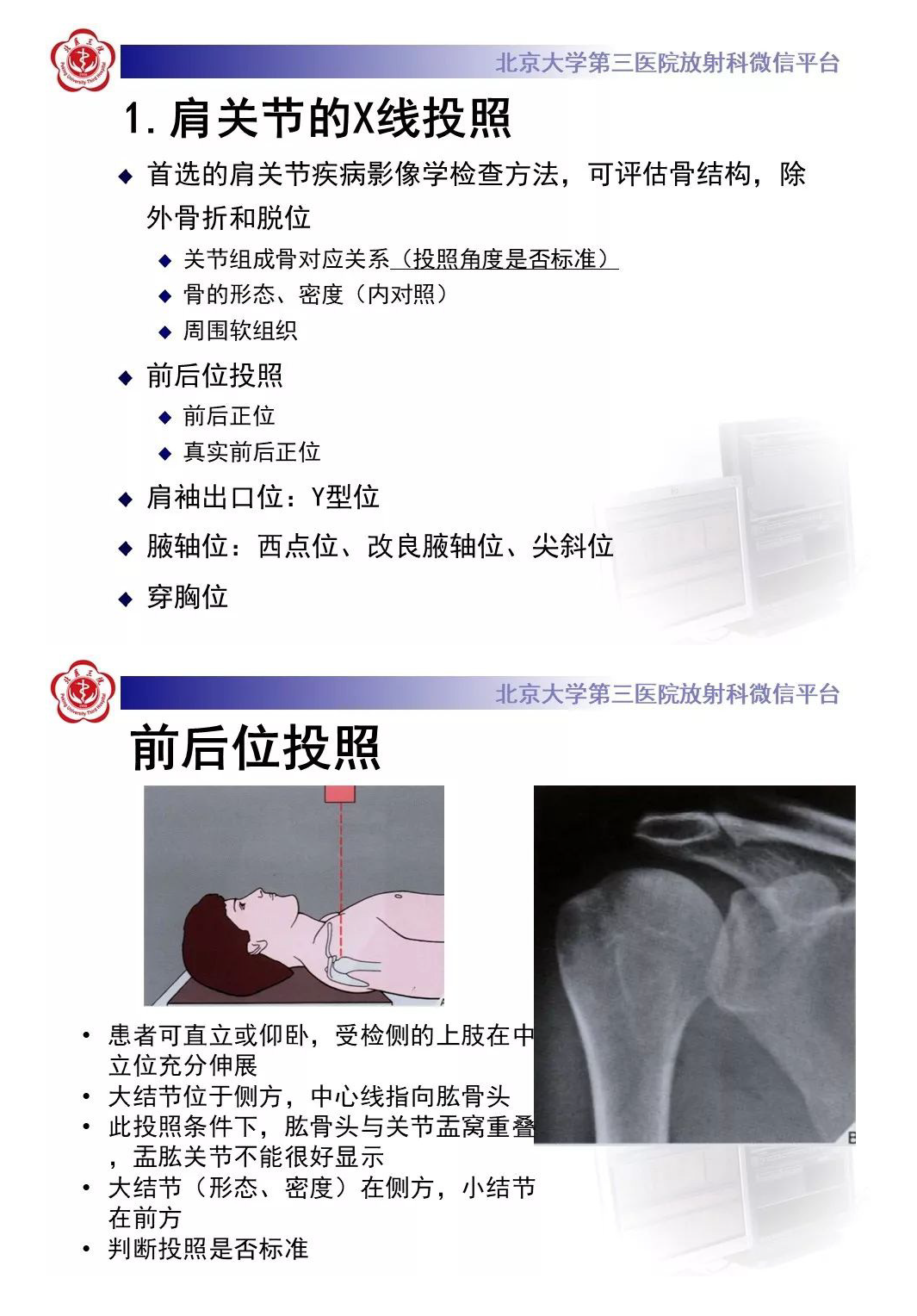 【PPT】肩袖疾病的X线检查及诊断-4