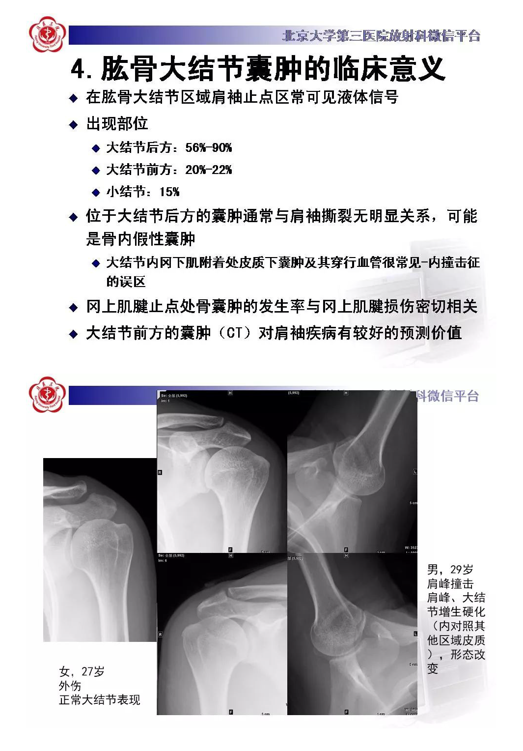 【PPT】肩袖疾病的X线检查及诊断-9