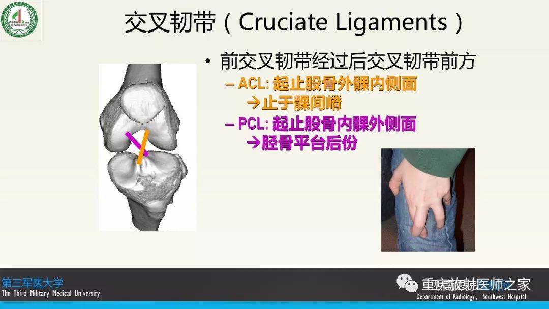 【PPT】膝关节韧带MRI诊断要点-4