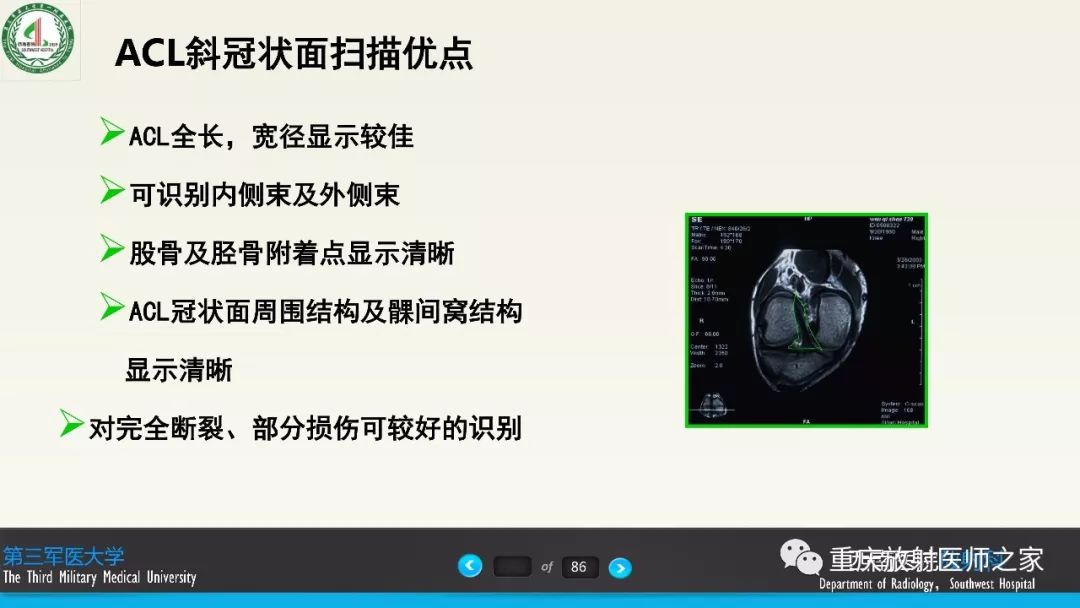 【PPT】膝关节韧带MRI诊断要点-63