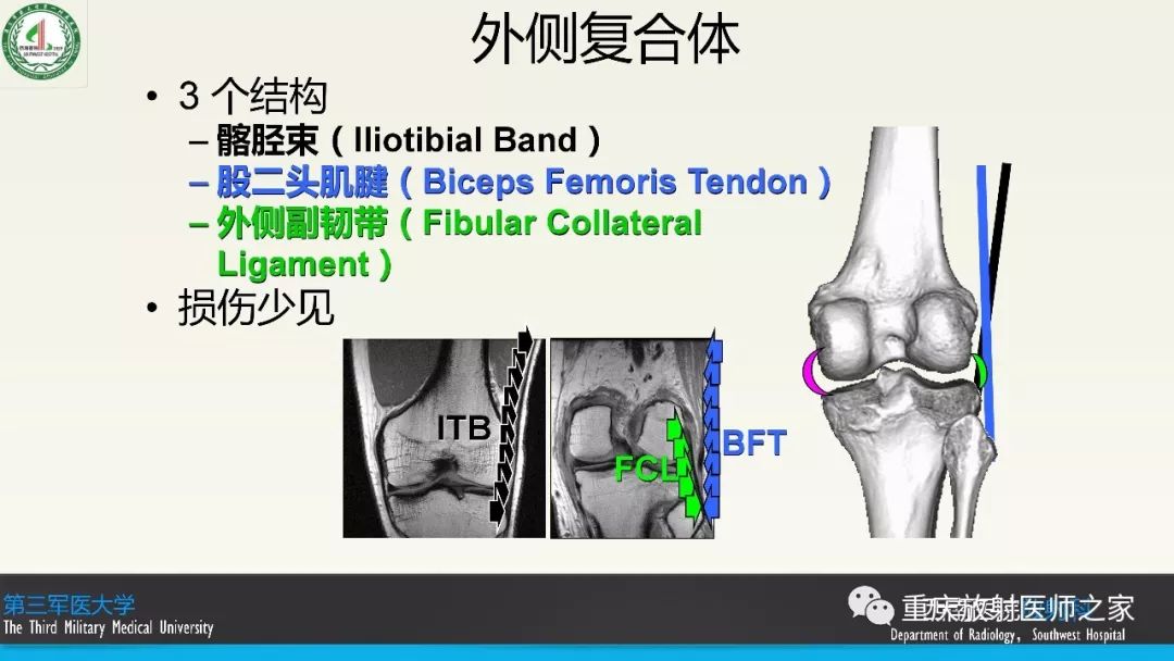 【PPT】膝关节韧带MRI诊断要点-17