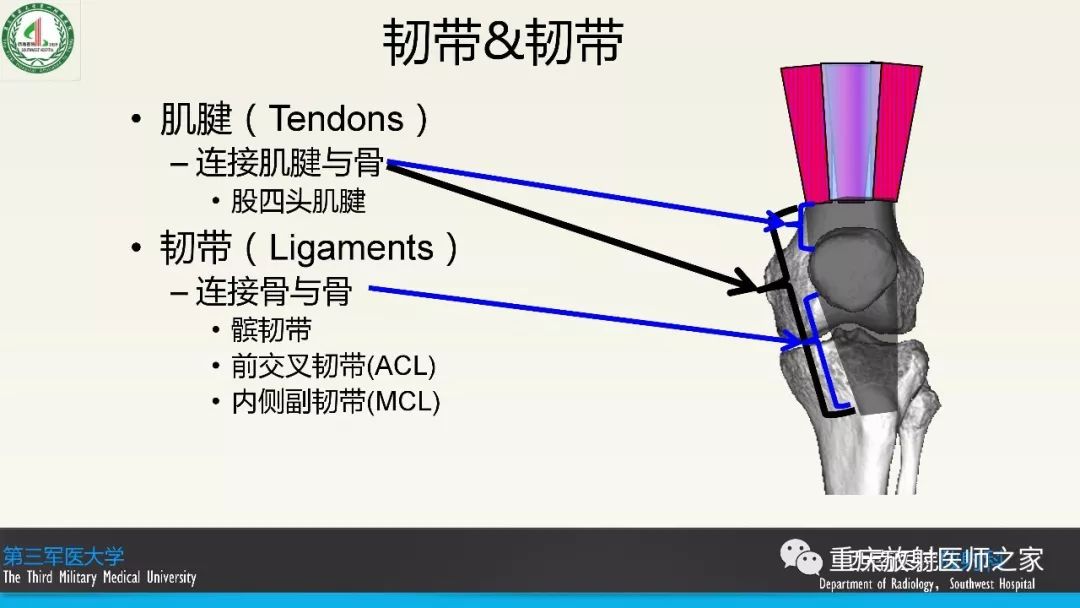【PPT】膝关节韧带MRI诊断要点-2