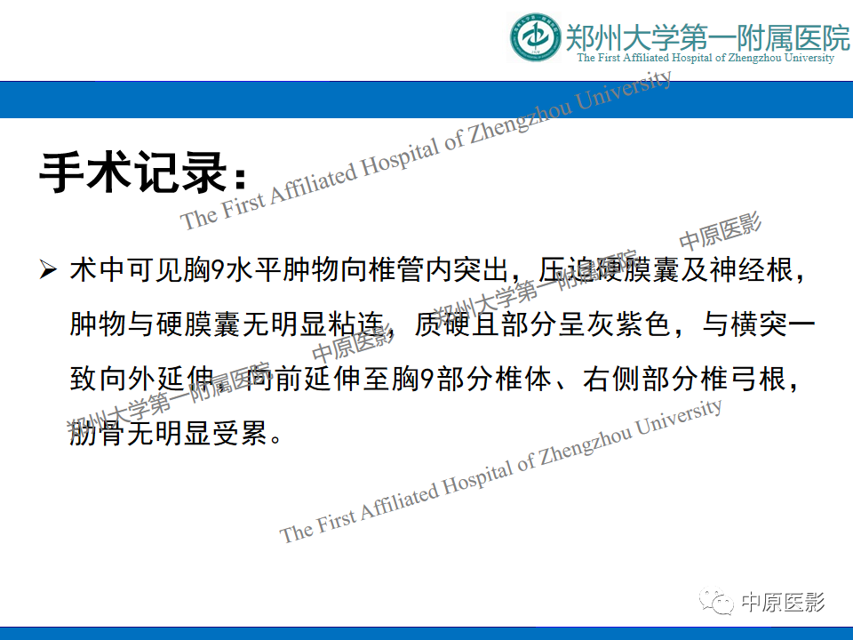 【病例】脊柱胸椎腱鞘巨细胞瘤1例CT及MR-1