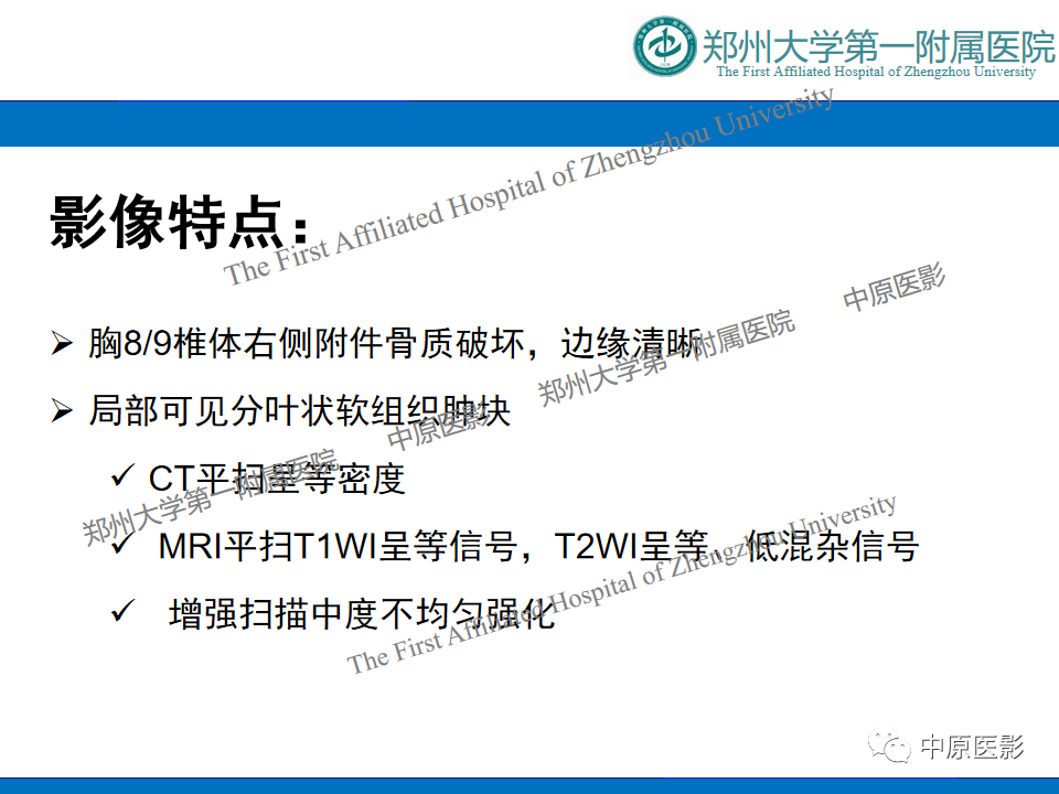 【病例】脊柱胸椎腱鞘巨细胞瘤1例CT及MR-12