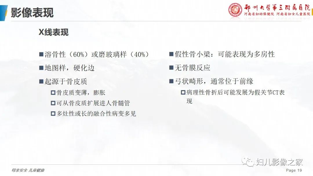 【PPT】骨纤维结构不良-19