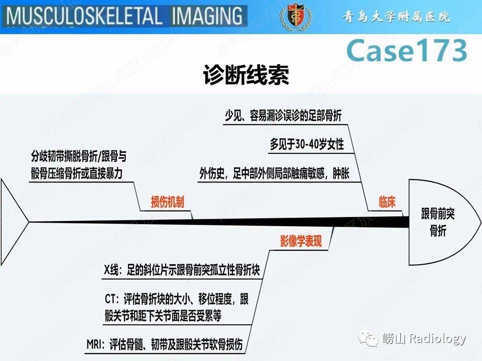 【PPT】跟骨前突骨折-25