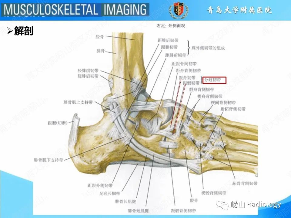 【PPT】跟骨前突骨折-13