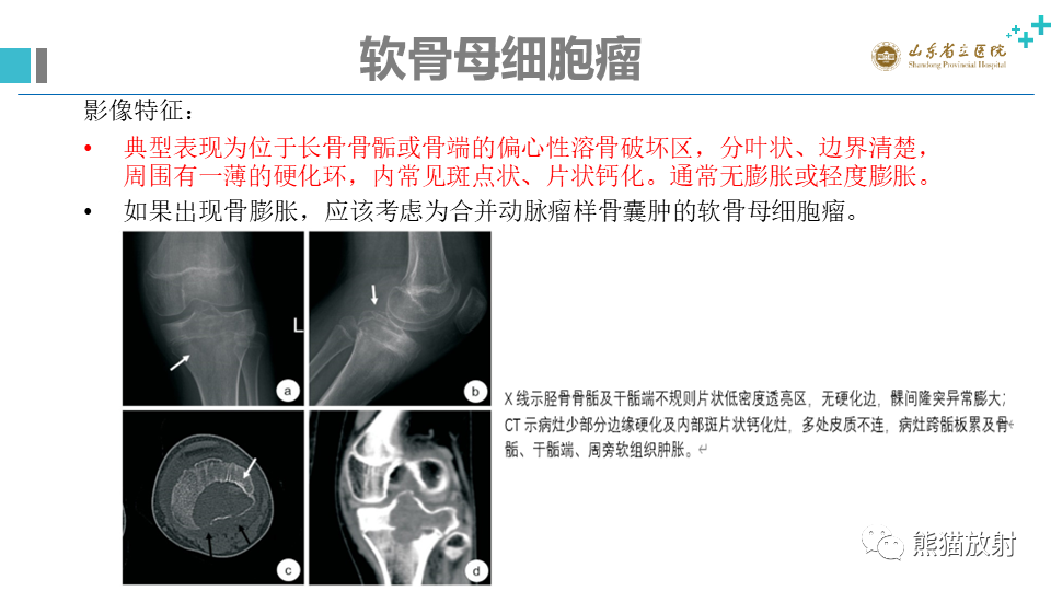 【病例】股骨远端动脉瘤样骨囊肿ABC VS 软骨母细胞瘤-13