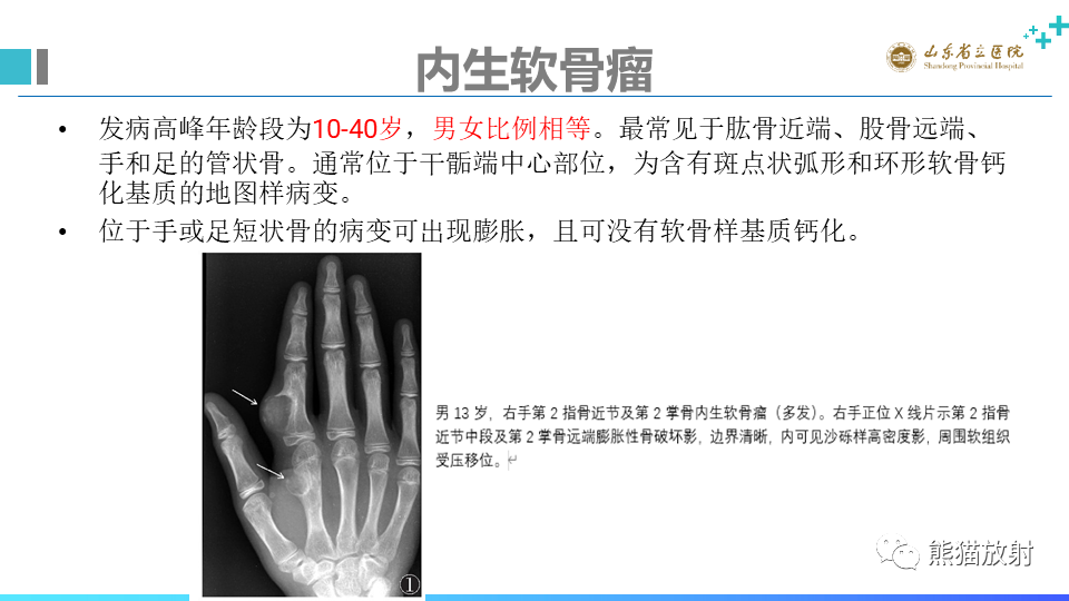 【病例】股骨远端动脉瘤样骨囊肿ABC VS 软骨母细胞瘤-18