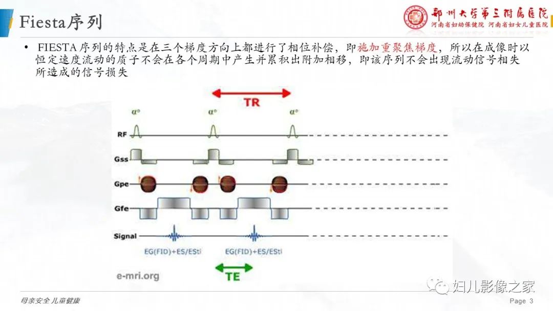 【PPT】3D fiesta序列在胎儿脊柱中的应用-3
