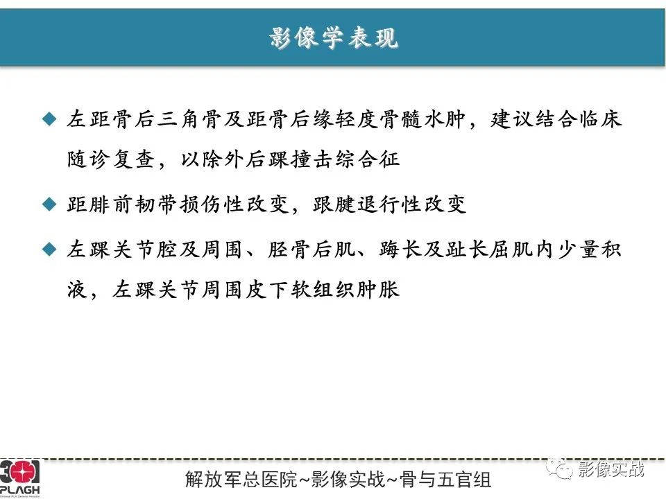 【病例】后踝撞击综合征1例MR影像-7