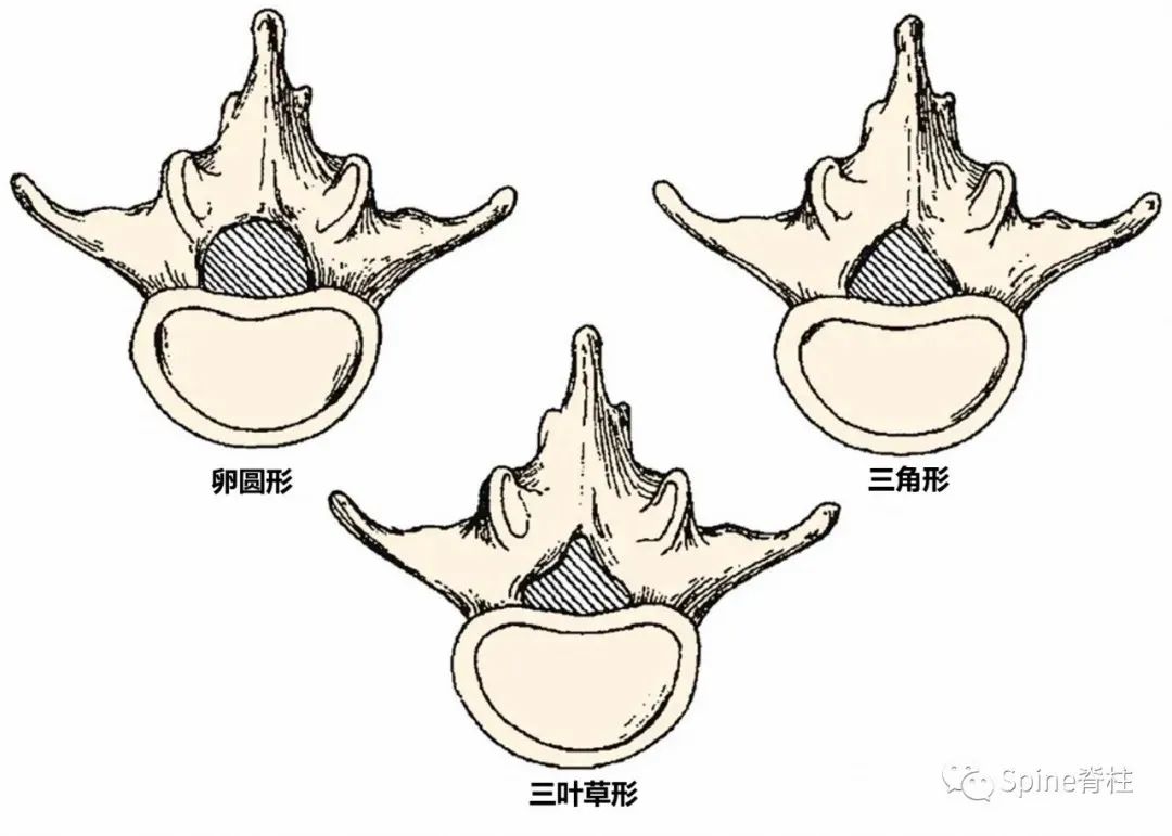 侧隐窝详细解剖-2 侧隐窝详细解剖-2
