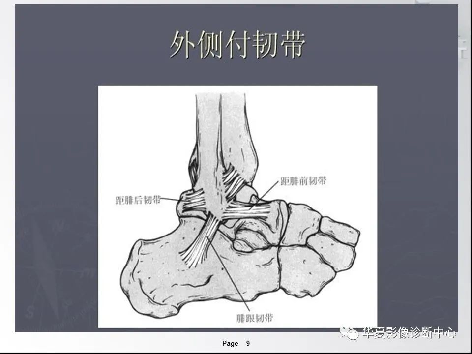 【PPT】踝关节韧带损伤MR表现与损伤机制分析-11 【PPT】踝关节韧带损伤MR表现与损伤机制分析-11