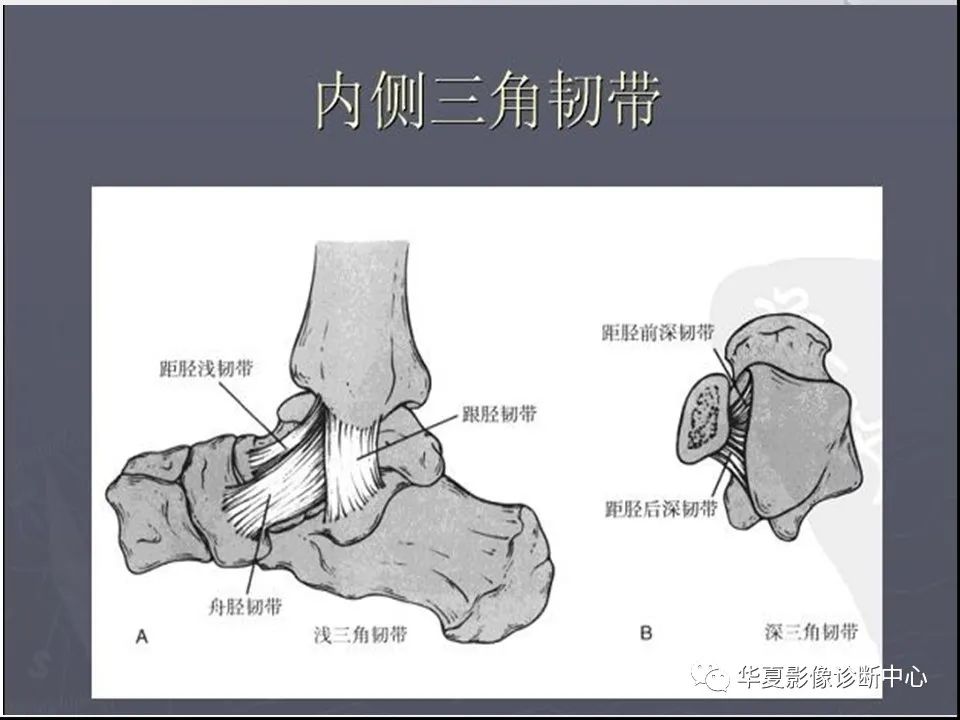 【PPT】踝关节韧带损伤MR表现与损伤机制分析-13 【PPT】踝关节韧带损伤MR表现与损伤机制分析-13