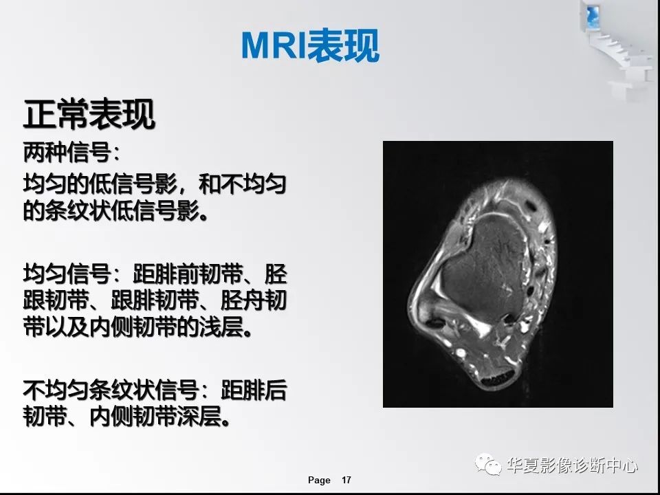【PPT】踝关节韧带损伤MR表现与损伤机制分析-19 【PPT】踝关节韧带损伤MR表现与损伤机制分析-19