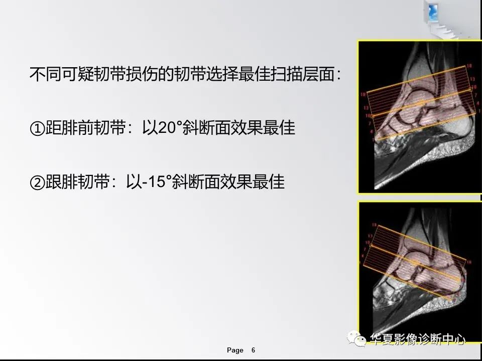 【PPT】踝关节韧带损伤MR表现与损伤机制分析-8 【PPT】踝关节韧带损伤MR表现与损伤机制分析-8