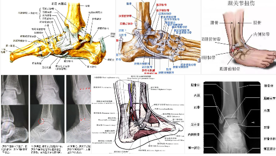 【PPT】踝关节韧带损伤MR表现与损伤机制分析-2 【PPT】踝关节韧带损伤MR表现与损伤机制分析-2