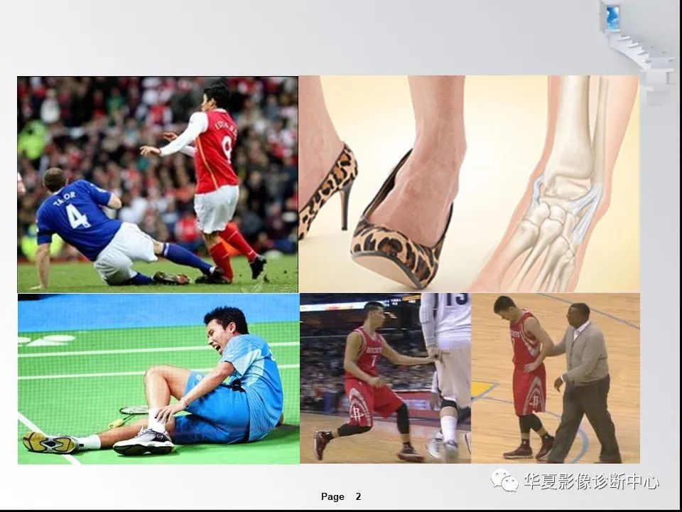 【PPT】踝关节韧带损伤MR表现与损伤机制分析-4 【PPT】踝关节韧带损伤MR表现与损伤机制分析-4